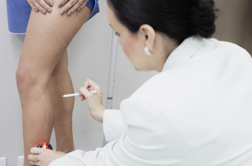  Cinco sinais que podem indicar problemas na circulação