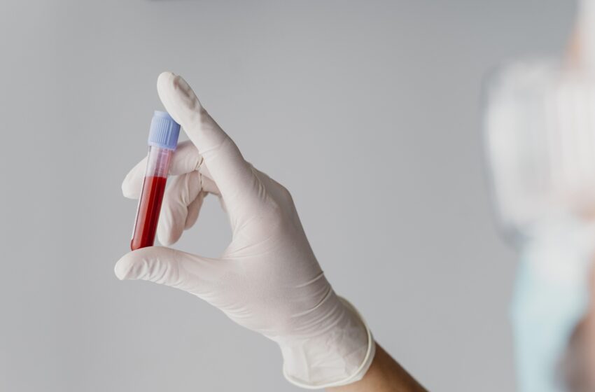 Transplante de medula óssea possibilita cura de 80 doenças