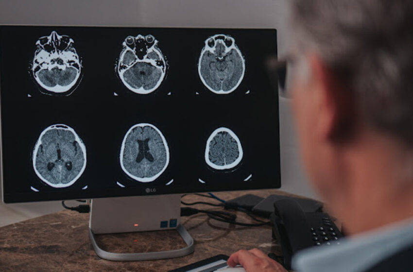  Setembro é o mês de conscientização do aneurisma cerebral