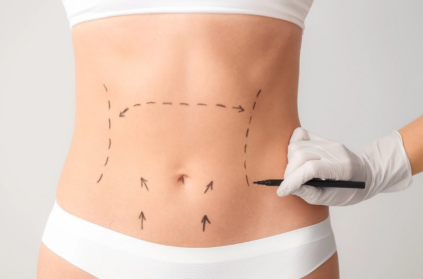  Avanços técnicos ajudam a reduzir cicatrizes cirúrgicas